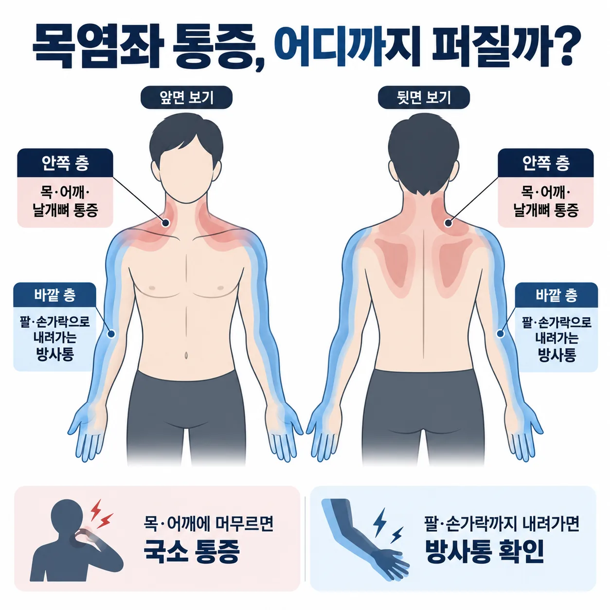 목염좌 통증이 어깨·날개뼈로 퍼지는 범위와 팔로 내려가는 범위를 두 층으로 구분해 표시한 그림
