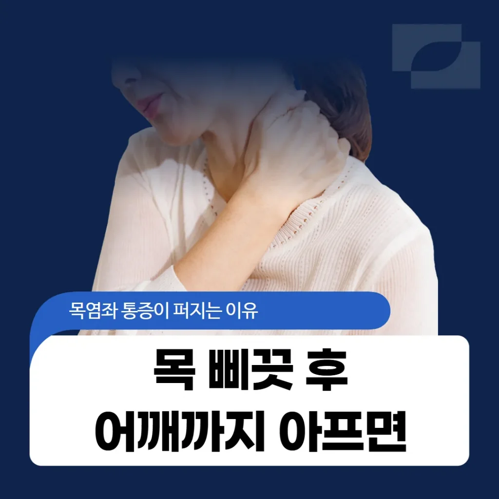 목 삐끗 후 어깨까지 아프면, 목염좌 통증이 퍼지는 이유